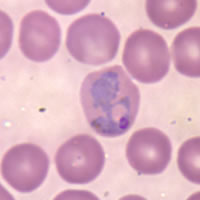 Rode bloedcel geïnfecteerd met P. vivax